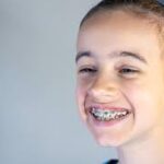 Teen Braces