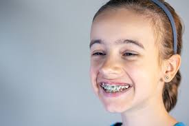 Teen Braces
